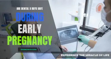 Dental X-Rays and Early Pregnancy: Understanding the Safety Concerns