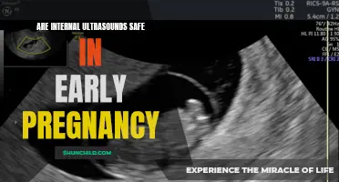 Internal Ultrasounds in Early Pregnancy: Understanding Safety and Benefits