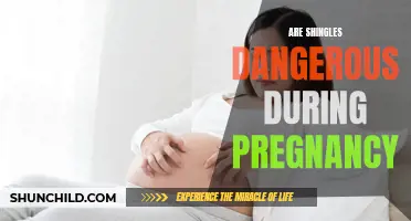 Understanding the Risks: Are Shingles Dangerous During Pregnancy?