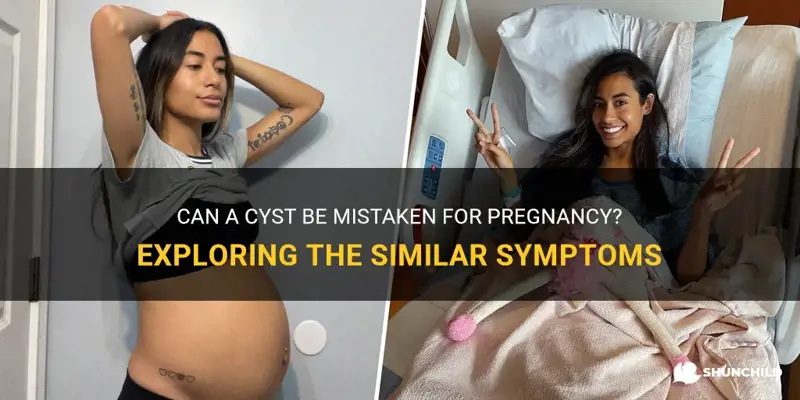 can a cyst be confused with pregnancy