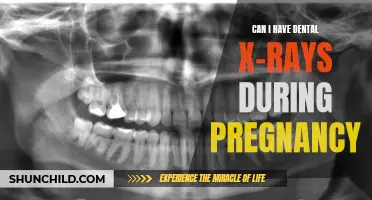 The Safety of Dental X-Rays During Pregnancy