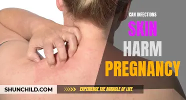 The Potential Harm of Skin Infections During Pregnancy