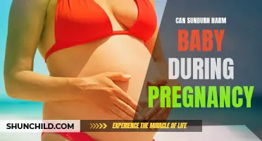 The Potential Dangers of Sunburn for Babies During Pregnancy