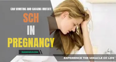 How Vomiting and Gagging Can Irritate SCH in Pregnancy