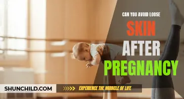 How to Avoid Loose Skin After Pregnancy