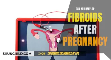 Understanding the Relationship Between Pregnancy and Fibroids: Can You Develop Fibroids After Pregnancy?