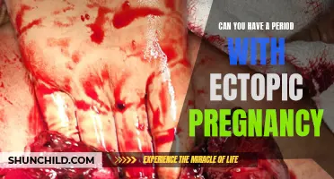 Can You Experience a Period with an Ectopic Pregnancy?