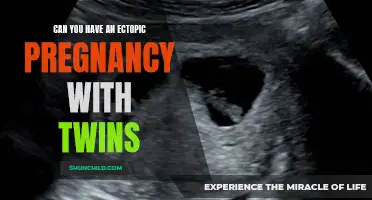 Exploring the Possibility of an Ectopic Pregnancy in Twins: What You Need to Know