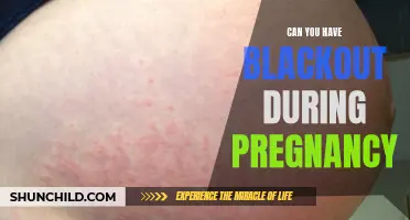 Can You Experience Blackouts During Pregnancy?