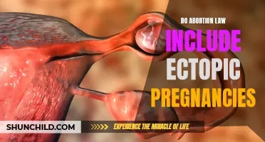 Exploring the Controversial Debate on Ectopic Pregnancies within Abortion Laws