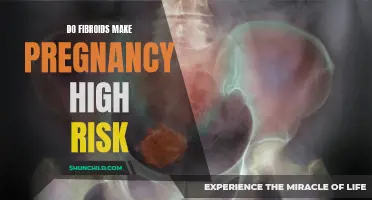Understanding the Link Between Fibroids and High-Risk Pregnancy