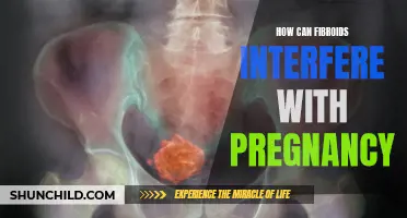 Understanding the Impact of Fibroids on Pregnancy: Interference and Risks