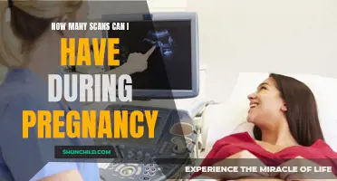 The Number of Scans You can Expect During Pregnancy
