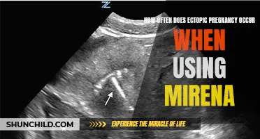 The Frequency of Ectopic Pregnancy when Using Mirena: A Closer Look