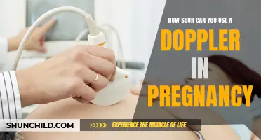 When is the Right Time to Start Using a Doppler in Pregnancy?