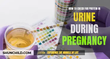Detecting Protein in Urine: A Guide for Expectant Mothers