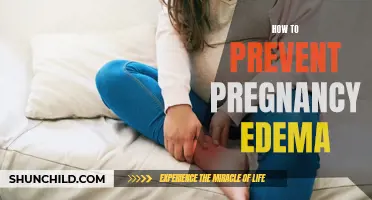 Preventing Pregnancy Edema: Tips to Reduce Swelling During Pregnancy