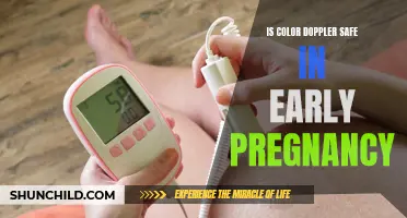 Color Doppler Use in Early Pregnancy: Safe Visualization of Fetal Development