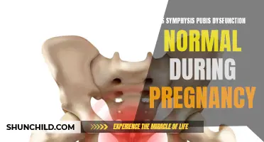 Understanding Symphysis Pubis Dysfunction: Is it Normal During Pregnancy?