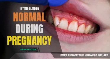 Understanding Teeth Bleeding during Pregnancy