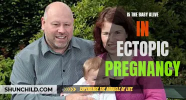 Understanding Ectopic Pregnancy: Is the Baby Alive?