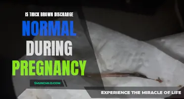 Understanding Thick Brown Discharge: Is it Normal During Pregnancy?