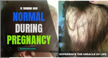 Is Thinning Hair a Normal Side Effect of Pregnancy?