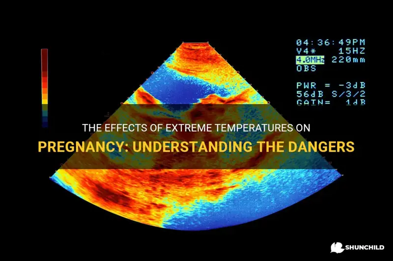 what temperature is dangerous for pregnancy
