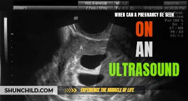 Understanding When a Pregnancy Can Be Seen on an Ultrasound
