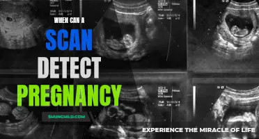 Understanding How Scans Can Detect Pregnancy