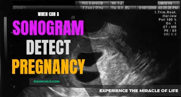 Understanding When Sonograms Can Detect Pregnancy