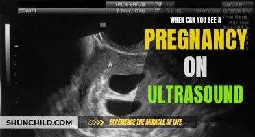 Stages of Pregnancy: When Can You See a Baby on Ultrasound?